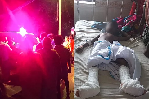Madurai caste crime: Dalits, including 5-yr-old boy, hacked with swords at playground