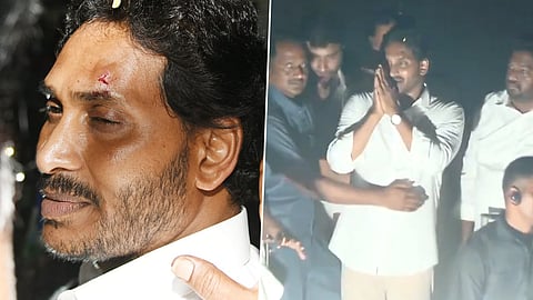 YS Jagan Mohan Reddy injured while campaiging in Vijayawada