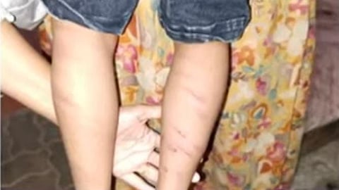 Kerala teacher at large after brutally assaulting UKG student, FIR lodged