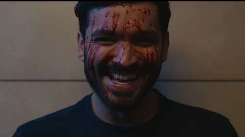 Diganth Manchale in Edagaiye Apaghatakke Karana, facing the screen with a bloodied face.