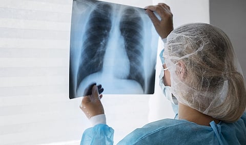 Understanding Chronic Thromboembolic Pulmonary Hypertension (CTEPH): A Comprehensive Guide