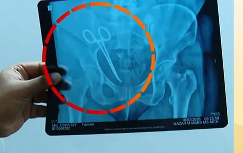 X-ray revealed the surgical instrument