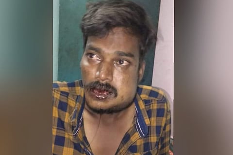 Tirupathi suffered fracture on his jaw