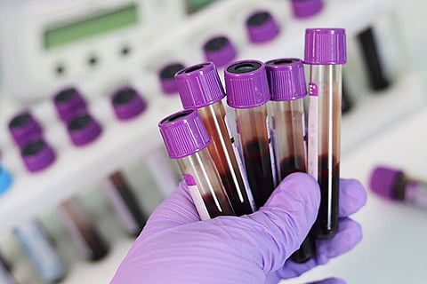 Test tube blood samples