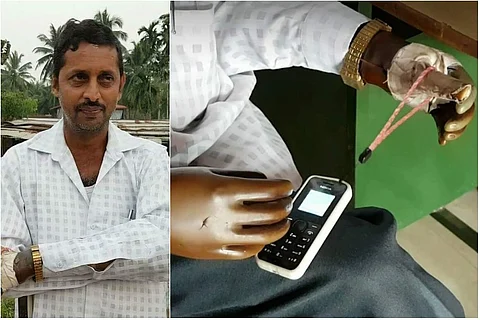 He lost both hands 15 yrs ago: Now, Ganesh Kamath runs a successful firm in Moodabidri