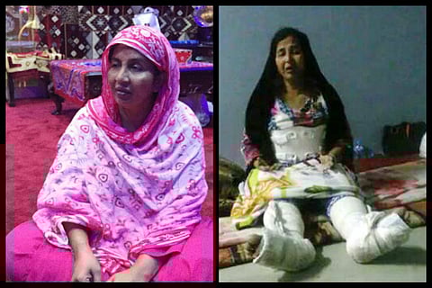 Hyderabad woman says Saudi employer tried to kill her, pushed her from third floor