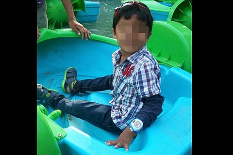 Bengaluru boy in coma after hand surgery, becoming stable