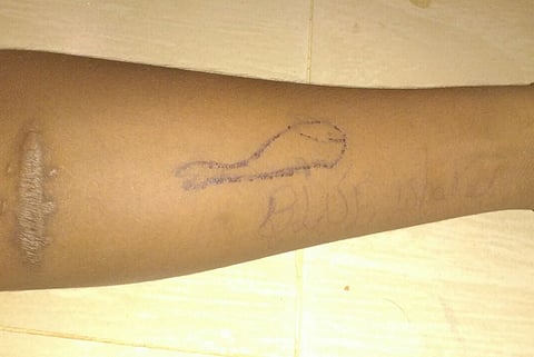 Madurai teen commits suicide, image of blue whale found on forearm