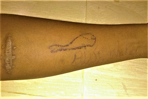 Madurai teen was playing a 'Blue Whale-like game', say cops: Who was giving instructions?