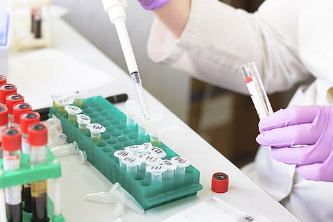 Reliance Industries eyes diagnostics biz, mulls starting pathology labs across India