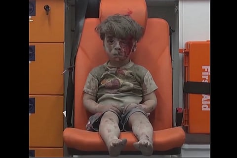 Omran Daqneesh could be a Baloch – would that matter?