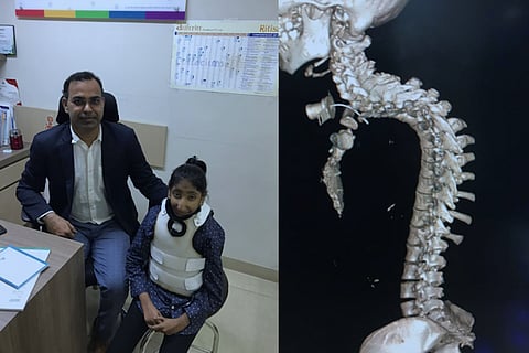 Bending life back into shape: How this child's staggering spine deformity was corrected