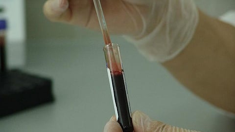 Image for Representation