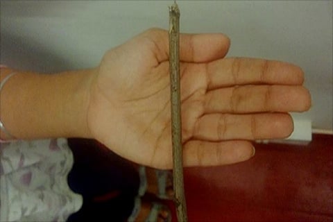 Why are Indian teachers so angry that they beat our children black and blue?