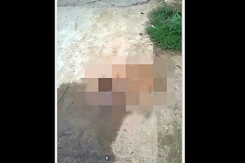 Three dogs poisoned in Hyderabad, pregnant dog dies after acid attack