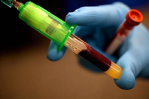 New blood test can detect pancreatic cancer in minutes