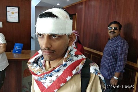 Tourists from Kerala come under attack by stone pelters in Kashmir, 7 injured