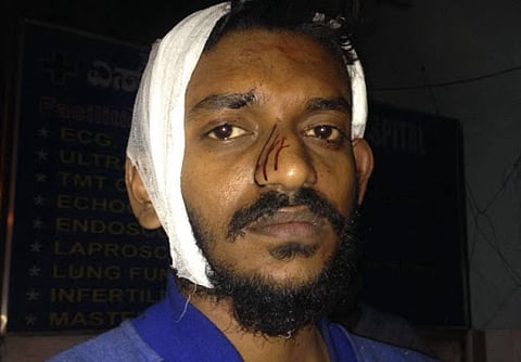Three students beaten up in Bengaluru, two from Kerala suffer injuries
