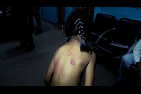 Bengaluru tuitions horror: Parents continued with teacher despite physical assault on kids