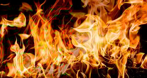 Miscreants set 15-yr-old girl on fire