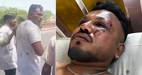 Ahmedabad plane crash