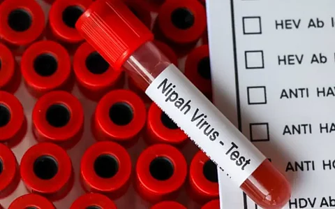 nipah virus
