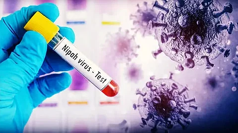 nipah virus