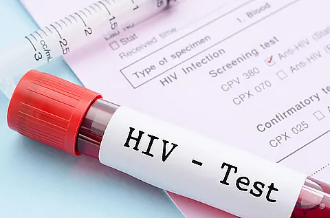 HIV transmission