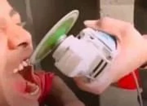 teeth polishing