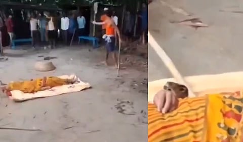Woman bitten by cobra