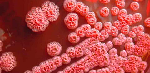 melioidosis