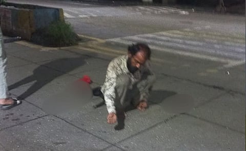 man killed a dog and playing with its eyes