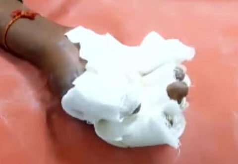 Hand