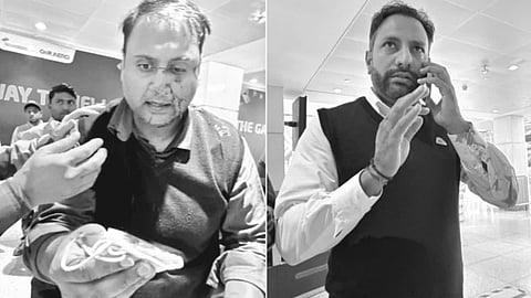 എയർ ഇന്ത്യ എക്സ്പ്രസ് പൈലറ്റിന്റെ ക്രൂരമർദനം: യാത്രക്കാരന്റെ മുഖത്ത് പരിക്ക്; പൈലറ്റിനെ പുറത്താക്കി | Pilot Assault