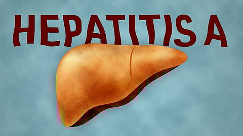 Hepatitis A