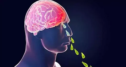 Amebic encephalitis