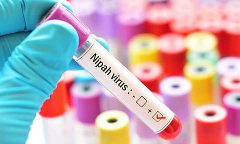 നിപയിൽ ആശ്വാസം; മൂന്ന് പേരുടെ പരിശോധനാഫലം നെഗറ്റീവ് | Nipah test results of three people are negative