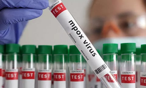 ആലപ്പുഴയില് ഒരാൾക്ക് എംപോക്സ് രോഗലക്ഷണം | A person in Alappuzha has symptoms of mpox