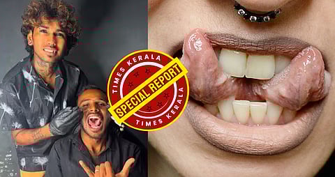 നാവ് രണ്ടായി പിളർന്ന് ടാറ്റൂ, സ്റ്റുഡിയോയിൽ ഓപ്പറേഷൻ; ഇൻസ്റ്റാ ‘സെലിബ്രിറ്റി’ അറസ്റ്റിൽ | Split tongue tattoo