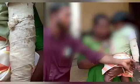 മൂന്ന് വയസുകാരിയുടെ കൈ പിടിച്ച് തിരിച്ചു; അംഗനവാടി അധ്യാപികക്കെതിരെ പരാതിയുമായി കുടുംബം