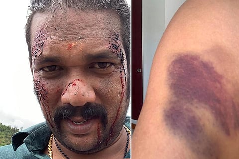 Sabumon Abdusamad reveals getting hurt during 'Ayyappanum Koshiyum' shoot