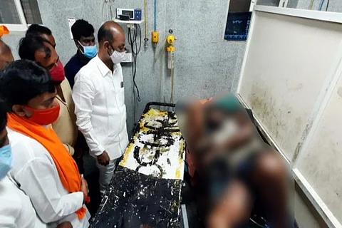 The man had suffered severe burns in the incident on November 1 and died on Thursday night while undergoing treatment at Yashoda hospital.