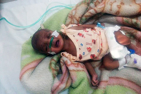 This 3-month-old baby is dying from a rare heart disease, and you can help her get surgery