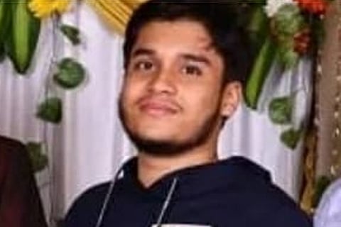 18-year-old set on fire by relatives in Bengaluru still critical, accused absconding