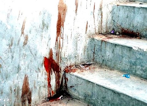 CPI (M), BJP workers hacked during New Year celebration in Kannur and Thiruvananthapuram