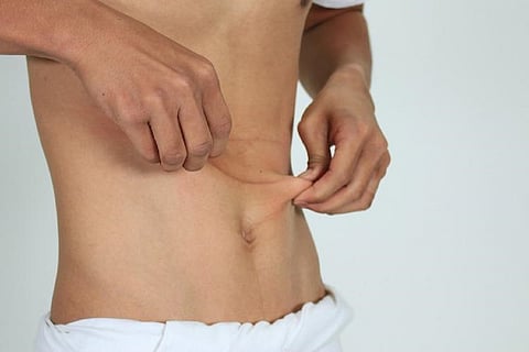 All You Need To Know About Irritable Bowel Syndrome, Diet, Tips And Guides