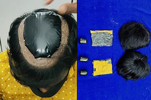 Chennai customs seized gold from a man who tried to hide it under a wig pasted to his scalp