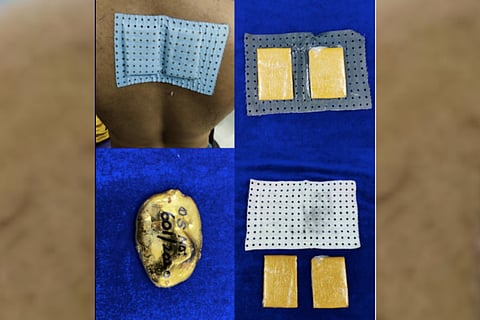 Chennai customs gold smuggling