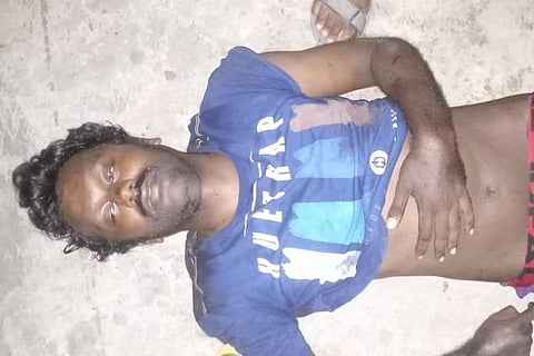 Chennai man, who attacked woman and jumped in front of train, dies