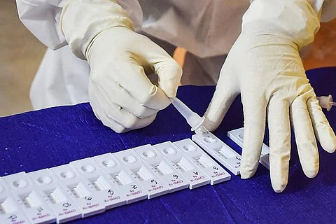 Image for representation of COVID-19 testing